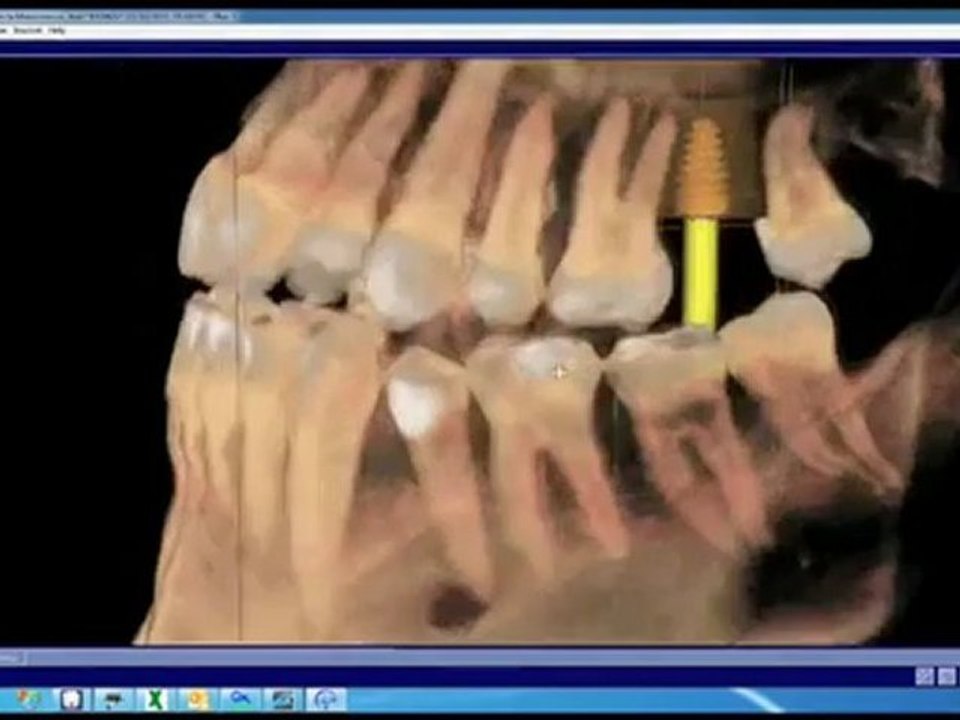 Cosmetic Dentist | Reconstructive Dentistry | Pretoria | Dr Ade Meyer