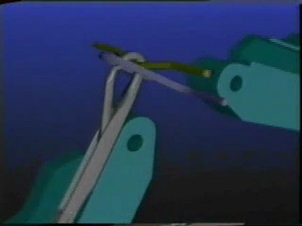 latch needle action