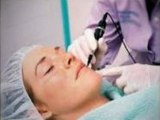 Laser Acne Scar Removal - Eliminate Blemishes In An Instant