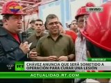  Hugo Chávez tendrá que volver a pasar por el quirófano