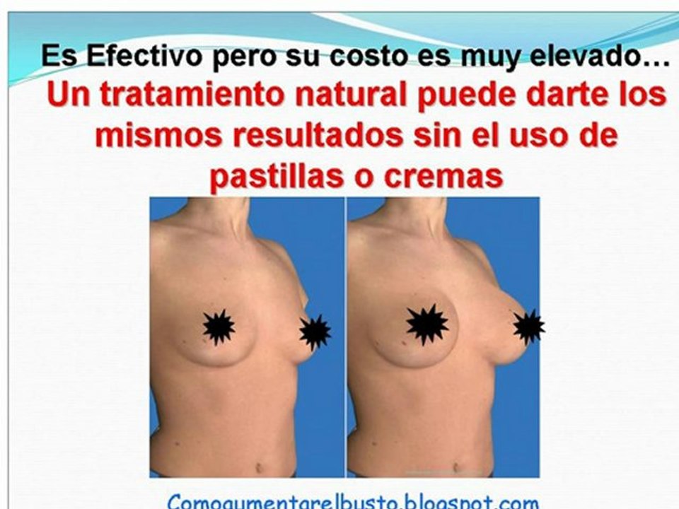 MAMOPLASTIA DE AUMENTO DE BUSTO O AUMENTO NATURAL DE BUSTO