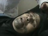 فري برس  حمص  باباعمرو إصابة إمرأة مسنة بشظايا 22 2 2012