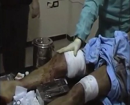 فري برس حمص باباعمرو رامي السيد في لحظاته الاخيرة 22 2 2012