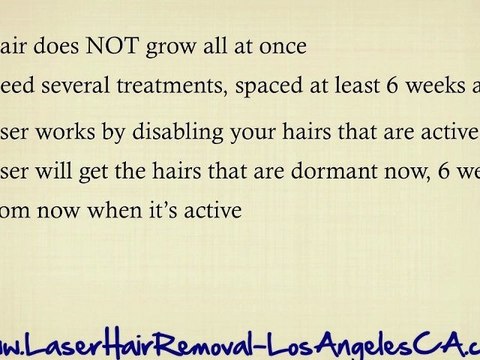 Laser Hair Removal Los Angeles CA