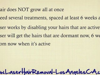 Laser Hair Removal Los Angeles CA