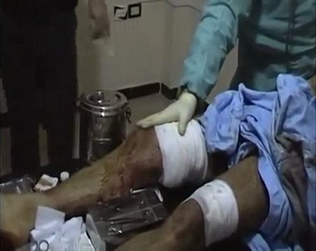 فري برس باباعمرو رامي السيد في لحظاته الاخيرة 22 2 2012