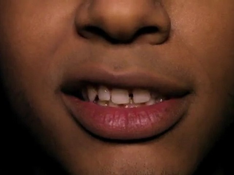 Radikal MC - Freestyle -2