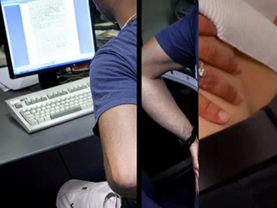 dolor ciatica tratamiento - aliviar dolor de ciatica - dolor de nervio ciatico