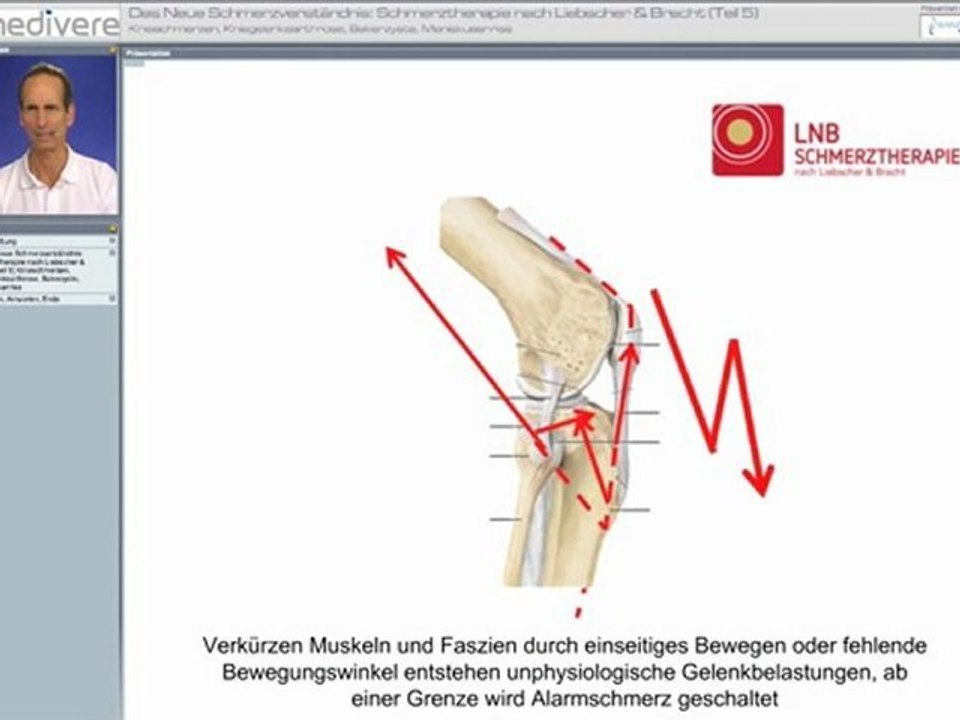 LNB-bei-Knieschmerzen-Teil-2
