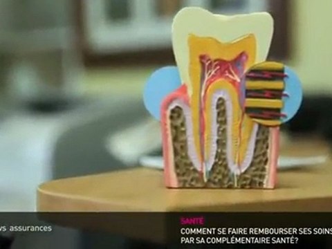 ‪Dentiste : Les tarifs et vos remboursements sécu et mutuelle