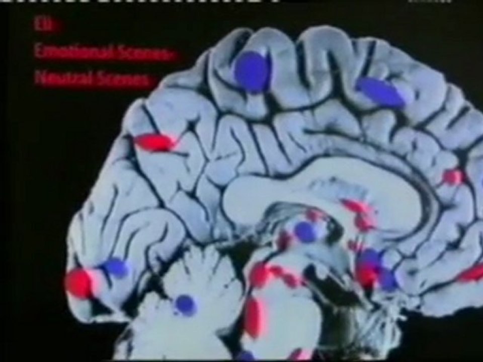 ¿Cerebro psicopata?: RMf