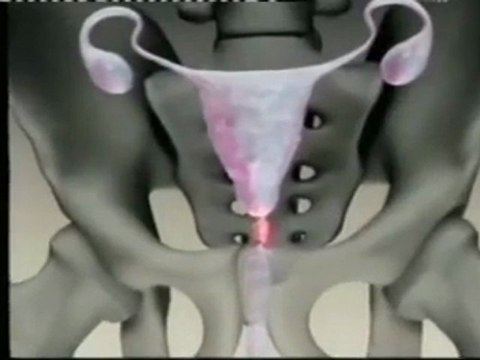 Fecundacion: La batalla de los espermatozoides