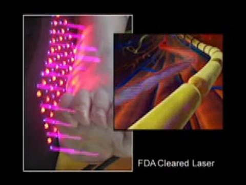 Peripheral Neuropathy Treatment - Atlanta, GA