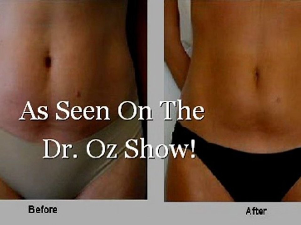 Cellulite Lotion Best