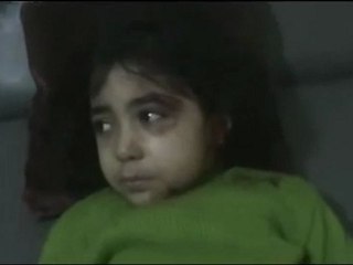 فري برس حمص باب تدمر اصابة طفلة بشظاية هاون 28 2 2012