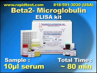 beta 2 Microglobulin ELISA kit
