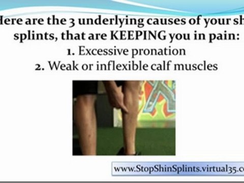 treating shin splints - how to avoid shin splints - preventing shin splints