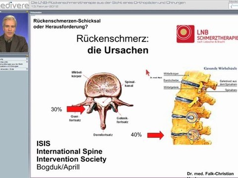 LNB-Dr-Heck-Rueckenschmerzen-Teil-1
