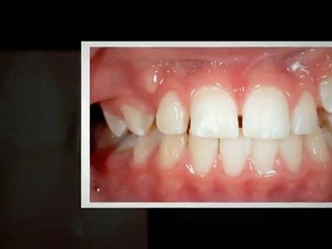 Parker Orthodontists Feb2012