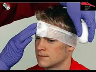 فري برس تنسيقية أطباء دمشق إسعاف الجروح الكبيرة وإصابات الوجه