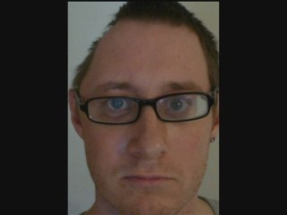 Man with half a head undergoes surgical reconstruction