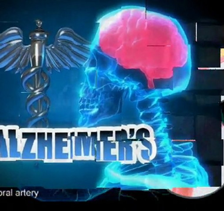 Moet & Chandon - Champagne - Health Promotion