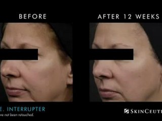 SkinCeuticals A.G.E. Interrupter at Fine Lines MedSpa