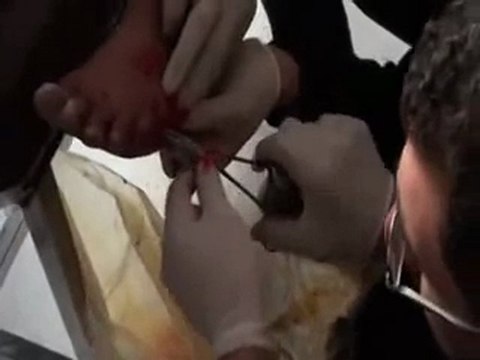 فري برس حمص حي الربيع العربي معالجة أحد الجرحى 2 3 2012