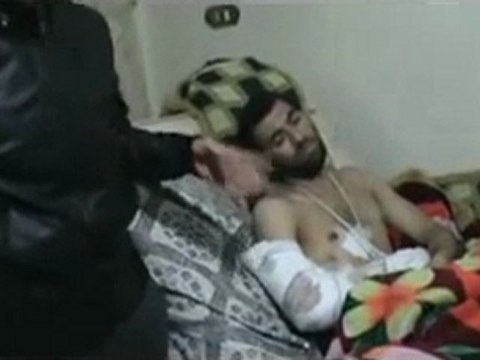 فري برس الناشط ملهم الجندي يشرح لنا كيف اصابة احد المواطنين