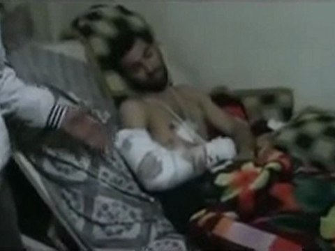 فري برس الناشط ابو جعفر يشرح لنا كيف اصابة احد المواطنين