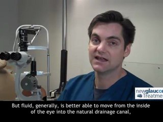 Canaloplasty (Glaucoma Treatment) | What If The Canal Is Not Fully Catheterized?