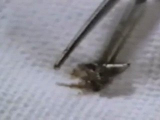 Rencontres Du 4eme Type , Implant E.Ts