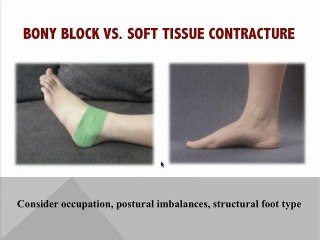 Beyond Stretching! Trigger Points & Limited Ankle Mobility