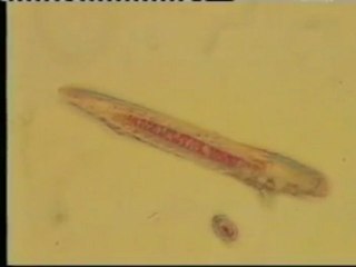 Parasitos: Acaros de las cejas (Demodex folliculorum)