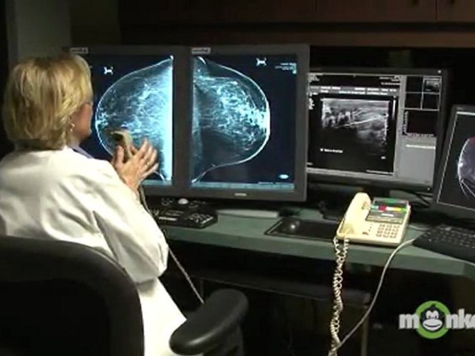 Need To Know Breast Cancer Facts