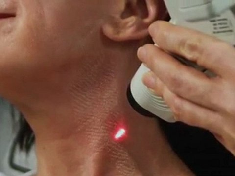 DermFx Deepfx Procedure Learn More About DermFx Deepfx Procedure Call: 562-592-5100