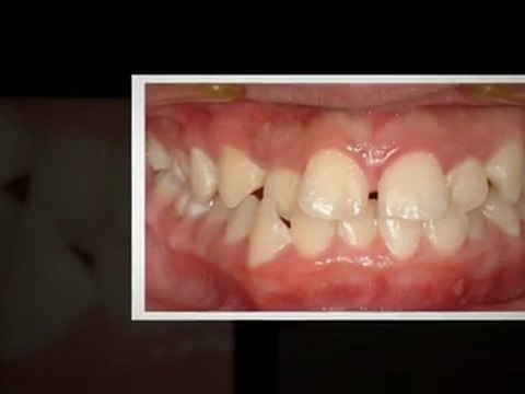 Orthodontists Westminster Feb2012