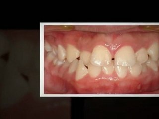 Orthodontists Westminster Feb2012