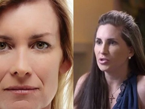 DermFx Radiesse Procedure Learn More About DermFx Radiesse Procedure Call 562-592-5100