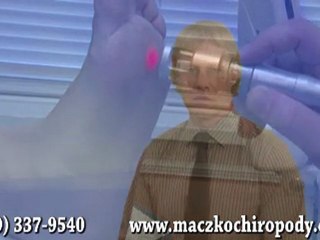 Laser Therapy for Foot Pain - Chiropodist in Sarnia, London, Chatham, ON