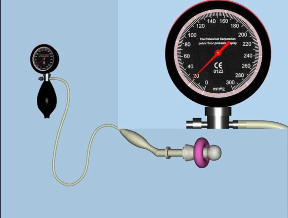 Rééducation du périnée : le Pelvexicer