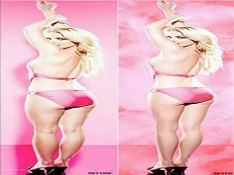 Contro Cellulite Rimedi Naturali [La cura naturalle]