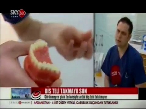 İlke Elgün Sky Turk 360 Plastik diş teli