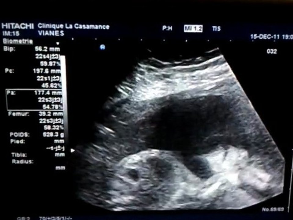 video-2011-12-15-19-01-52