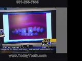 Dental Implants Utah - Benefits of Dental Implants