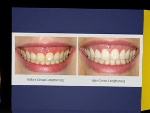 Periodontist Seattle