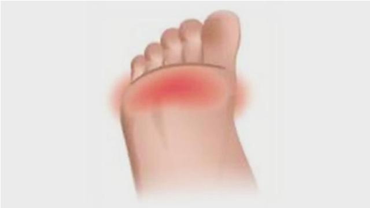 How To Manage Pain In Ball Of Foot