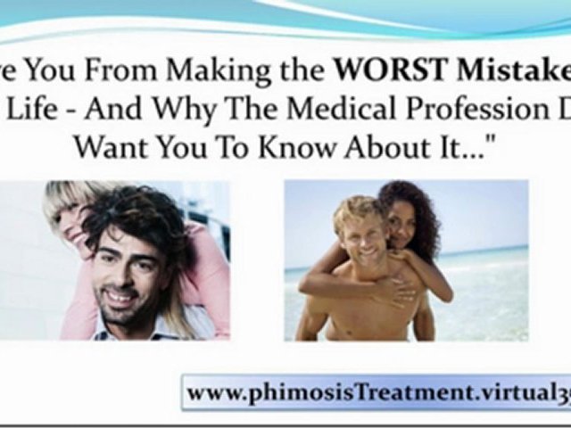 phimosis treatment emedicine – phimosis treatment options