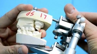 Dental Articulator, Universal Articulator