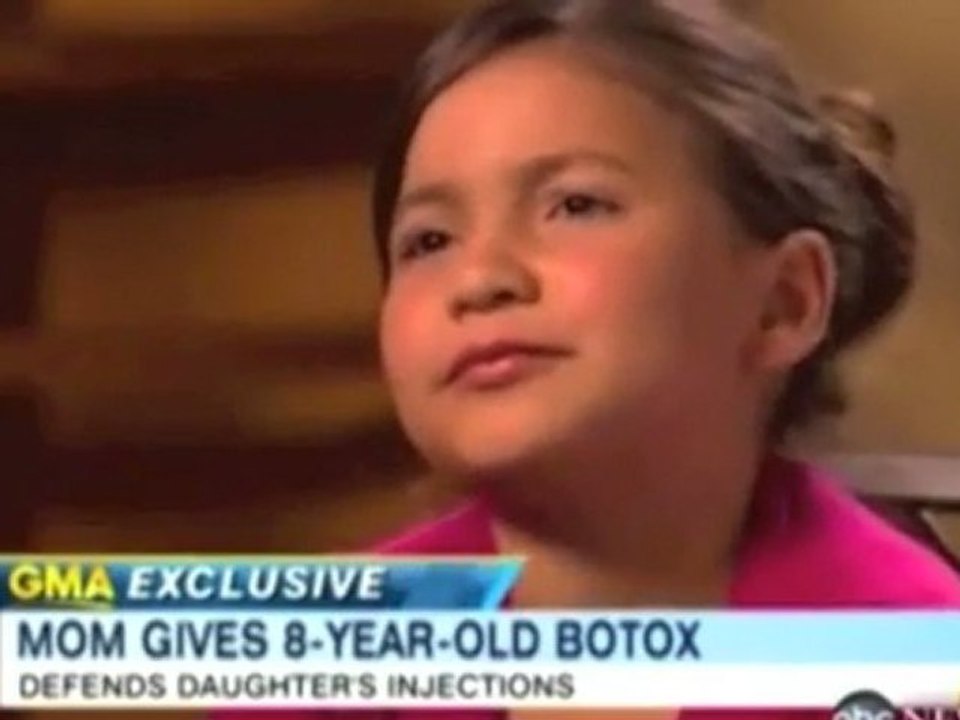 Botox copy321
